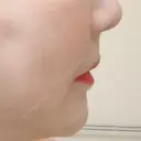 その他（審美歯科/矯正歯科） / 矯正（ワイヤー） / セラミック アニバーサリーデンタルギンザ DAY 1449 サムネイル用