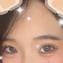 ヒアルロン酸注入（涙袋） 城本クリニック 長崎院 AFTER サムネイル用