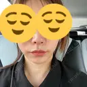 ボトックス（エラ・小顔） ルラ美容クリニック 大宮院 / ルラスキンクリニック 大宮院 DAY 14 サムネイル用