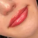 アートメイク（唇） Brandnew Beauty Clinic AFTER サムネイル用