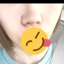 小鼻縮小（切開） / 鼻尖形成（非切開） / その他（鼻） CLINIC W DAY 0 サムネイル用