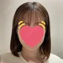 脂肪吸引（顔） BLINC CLINIC （ブリンク クリニック） AFTER サムネイル用