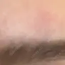 医療脱毛（顔） 共立美容外科 福岡院 DAY 0 サムネイル用