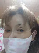 リジュラン 湘南美容クリニック 所沢院 DAY 9 サムネイル用