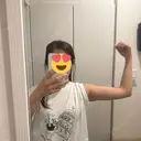 脂肪吸引（二の腕） Mods Clinic（モッズクリニック） 東京院 AFTER サムネイル用