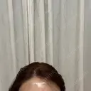 脂肪注入（額） Mods Clinic（モッズクリニック） 福岡院 DAY 0 サムネイル用