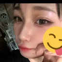 小鼻縮小（切開） / 鼻尖形成（非切開） / その他（鼻） CLINIC W DAY 17 サムネイル用