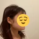 脂肪吸引（顔） / ボトックス（エラ・小顔） ネビュラクリニック 京都院 DAY 3 サムネイル用