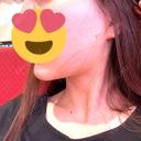 糸リフト / 脂肪吸引（顔） / ジョールファット除去 / ボトックス（エラ・小顔） R Beauty CLINIC 名古屋院 DAY 2 サムネイル用