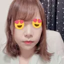鼻尖形成（切開） / 軟骨移植 / ヒアルロン酸注入（鼻） / ヒアルロン酸注入（あご） ASTRA BEAUTY CLINIC DAY 5 サムネイル用