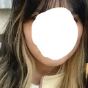 ボトックス（エラ・小顔） さっぽろ美容クリニック AFTER サムネイル用