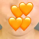 糸リフト アリエル美容クリニック 郡山院 DAY 9 サムネイル用