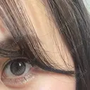 ヒアルロン酸注入（涙袋） ファイヤークリニック 銀座院 DAY 4 サムネイル用