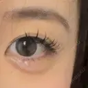 ヒアルロン酸注入（涙袋） ファイヤークリニック 銀座院 DAY 9 サムネイル用