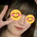 隆鼻術 / 鼻尖形成（切開） / 鼻中隔延長（切開） / 軟骨移植 R Beauty CLINIC 銀座院 DAY 113 サムネイル用