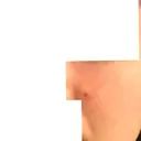 ほくろ・いぼ除去レーザー（肌） フェアクリニック川口 DAY 10 サムネイル用