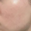 ルメッカ ルラ美容クリニック 福岡本院 DAY 5 サムネイル用
