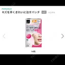 ほくろ・いぼ切除（肌） Jスキンクリニック 【J-SKIN clinic】 DAY 2 サムネイル用