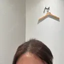 脂肪注入（額） Mods Clinic（モッズクリニック） 福岡院 DAY 29 サムネイル用