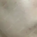 ポテンツァ 渋谷美容外科クリニック 横浜院 DAY 14 サムネイル用