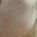 ポテンツァ 渋谷美容外科クリニック 横浜院 DAY 15 サムネイル用