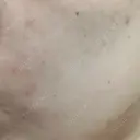 ポテンツァ 渋谷美容外科クリニック 横浜院 DAY 17 サムネイル用