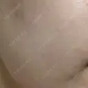 ポテンツァ 渋谷美容外科クリニック 横浜院 AFTER サムネイル用