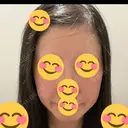 光治療（フォトフェイシャルなど） DMTC美容皮膚科 大宮院 DAY 18 サムネイル用