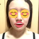 ボトックス（あご） / ボトックス（エラ・小顔） / ボトックス（肩） / ハイフ（顔） TCB東京中央美容外科 船橋院 DAY 2 サムネイル用