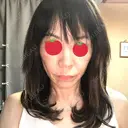 ボトックス（あご） / ボトックス（口角） / ボトックス（眉間） / ボトックス（目尻） / ボトックス（額） / ボトックス（人中） DMTC美容皮膚科 大宮院 DAY 0 サムネイル用