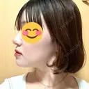 ボトックス（あご） / ボトックス（エラ・小顔） / ボトックス（肩） / ハイフ（顔） TCB東京中央美容外科 船橋院 DAY 7 サムネイル用