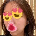 ピコレーザートーニング（美白・肝斑） / レーザートーニング（美白・肝斑） ルラ美容クリニック 渋谷本院 AFTER サムネイル用