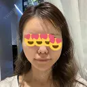 糸リフト Tokyo Tensei Clinic 銀座院 AFTER サムネイル用