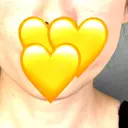 糸リフト アリエル美容クリニック 郡山院 AFTER サムネイル用