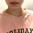 ハイフ（顔） しらさぎ形成クリニック 徳島院 AFTER サムネイル用