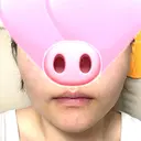 ボトックス（エラ・小顔） / ボトックス（口角） ビューティースキンクリニック 池袋院 DAY 0 サムネイル用