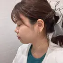 脂肪吸引（顔） R Beauty CLINIC 名古屋院 DAY 35 サムネイル用