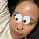 水光注射（ハリ・美肌） 小木曽クリニック DAY 3 サムネイル用