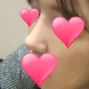 隆鼻術 / 鼻尖形成（切開） / 鼻中隔延長（切開） / 小鼻縮小（切開） / その他（鼻） / 骨切幅寄せ / 美容点滴・美容注射（美肌） FROM B整形外科 (旧バウム整形外科) DAY 16 サムネイル用