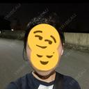 糸リフト / バッカルファット除去 / 脂肪吸引（顔） / ボトックス（エラ・小顔） RIVER CLINIC（リバークリニック） AFTER サムネイル用