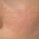 その他（肌） YAYOI CLINIC DAY 8 サムネイル用