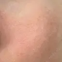 その他（肌） YAYOI CLINIC DAY 9 サムネイル用