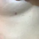 豊胸（脂肪注入） ドクターフィット（Dr.fit）クリニック DAY 55 サムネイル用