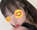 鼻尖形成（切開） / 鼻中隔延長（切開） / 軟骨移植 / ワシ鼻修正・ハンプ切除 / 鼻修正 R Beauty CLINIC 銀座院 DAY 30 サムネイル用