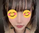 鼻尖形成（切開） / 鼻中隔延長（切開） / 軟骨移植 / ワシ鼻修正・ハンプ切除 / 鼻修正 R Beauty CLINIC 銀座院 DAY 232 サムネイル用