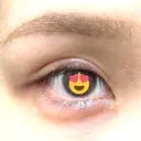 その他（目元） グリシーヌクリニック DAY 7 サムネイル用