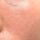 その他（肌） YAYOI CLINIC AFTER サムネイル用