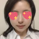 鼻尖形成（切開） / 鼻中隔延長（切開） / 小鼻縮小（切開） / 軟骨移植 / 鼻尖縮小 HANABI整形外科 DAY 20 サムネイル用