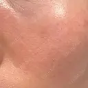 その他（肌） YAYOI CLINIC DAY 4 サムネイル用