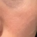 その他（肌） YAYOI CLINIC DAY 6 サムネイル用